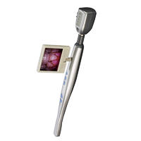 Dental Camera Pocket Intra Oral Camera