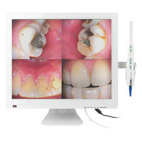 Intra Oral Camera+17 Inch LCD M-978V+CF-989